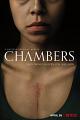 心室 Chambers